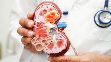 Gejala Kanker Ginjal: Dari Darah di Urine hingga Nyeri Pinggang